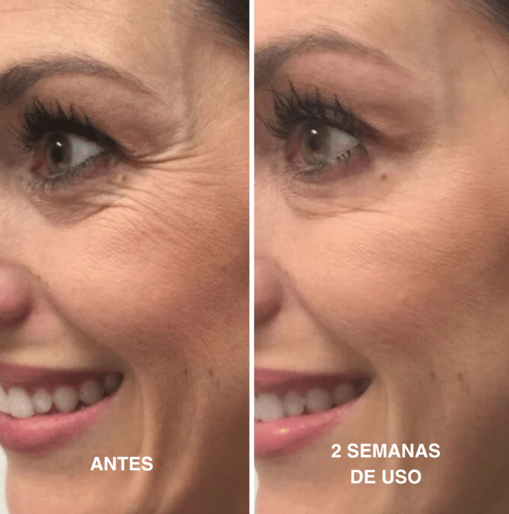 Renovéa Retinal Shot 0.1% — Recuperá una piel más firme, lisa y luminosa