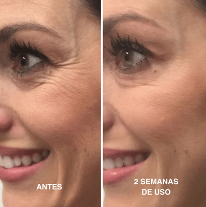 Renovéa Retinal Shot 0.1% — Recuperá una piel más firme, lisa y luminosa