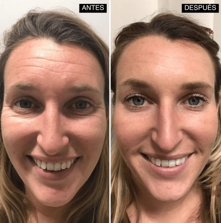 Renovéa Retinal Shot 0.1% — Recuperá una piel más firme, lisa y luminosa